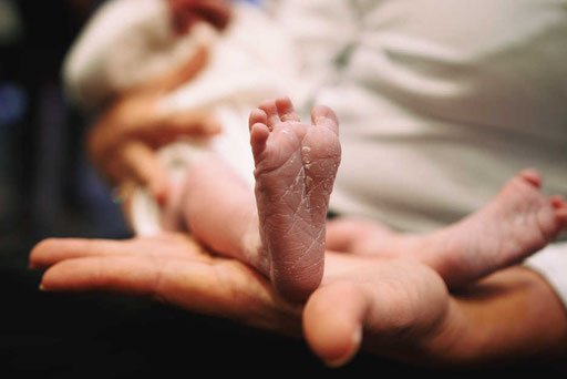 כפות רגליים בצילומי הניו בורן לפני ברית המילה